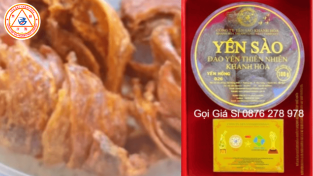 1nats-yen-sao-chung-yen-huyet-a1